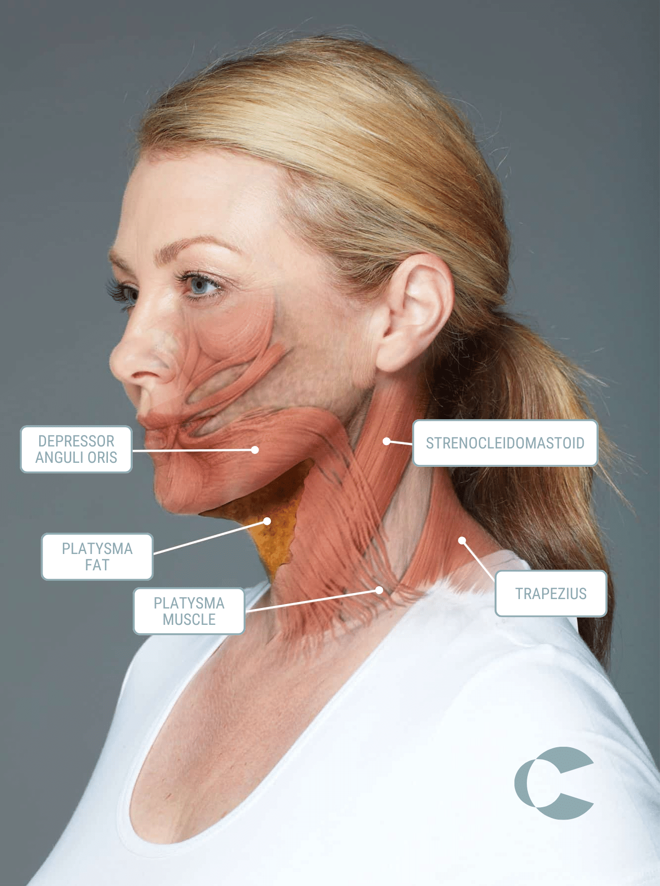 How under chin fat and platysma anatomy sit in relation to treatment for a double chin