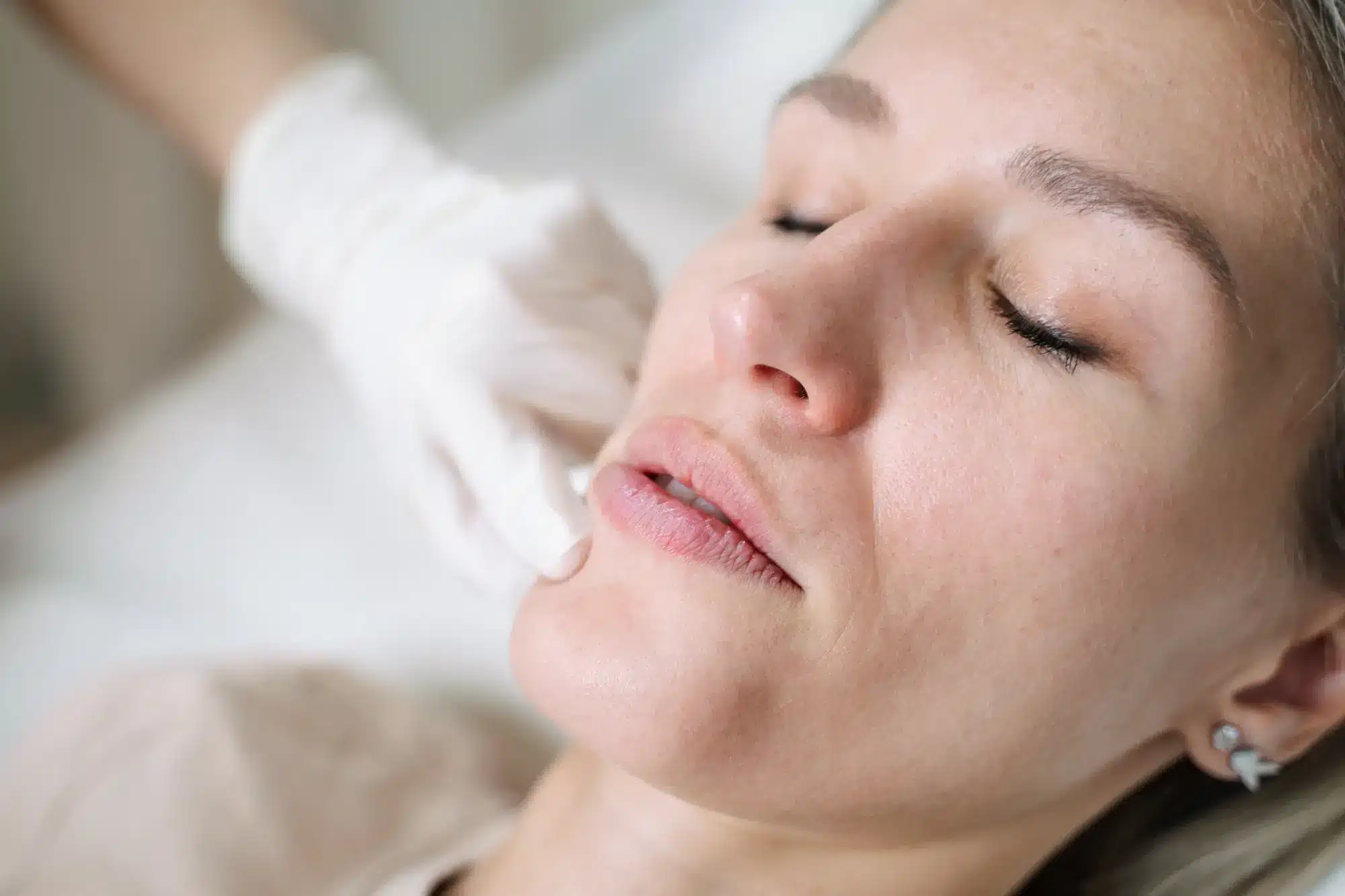 Lip Volume Enhancement Sydney and Brisbane with Contour Clinics