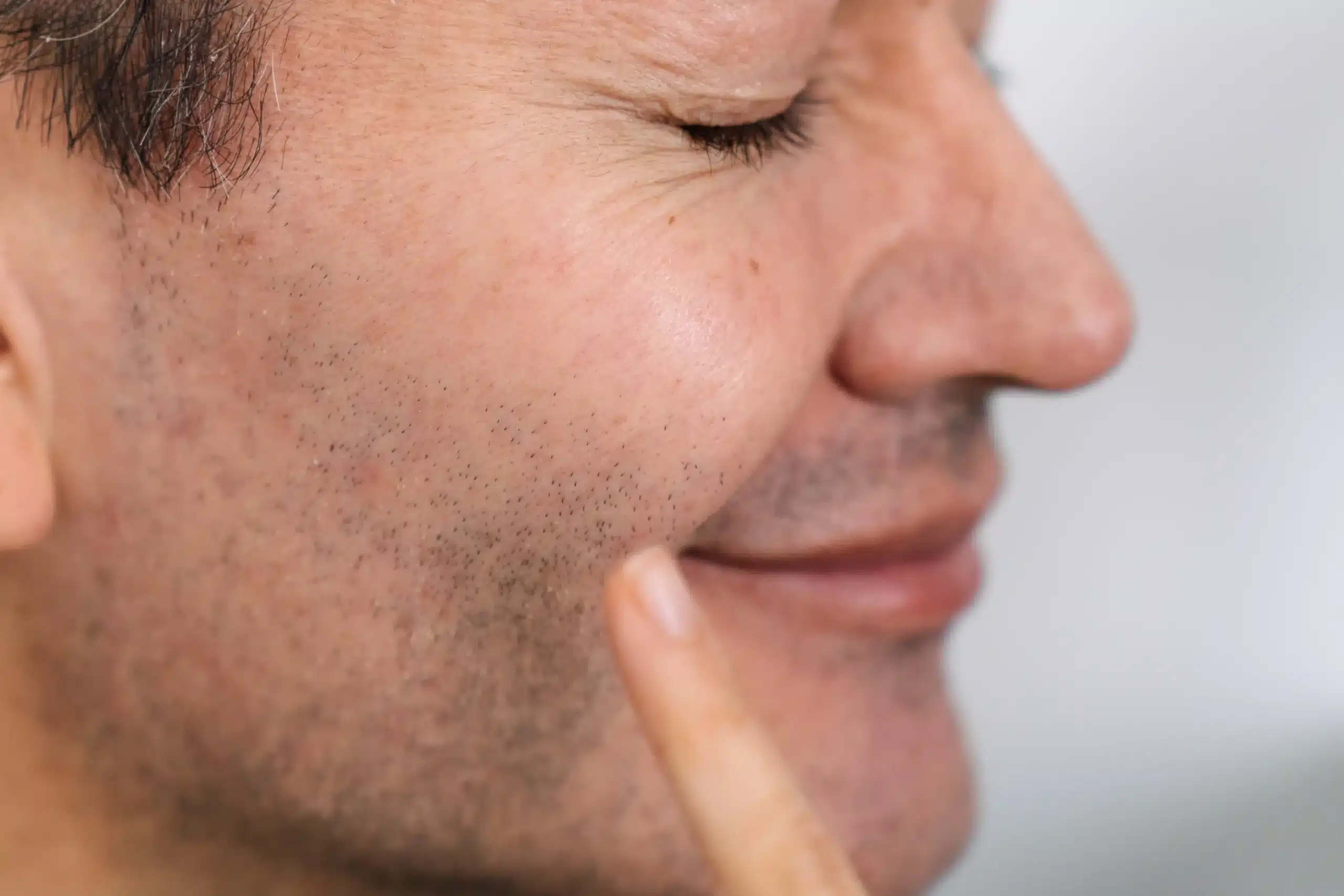 Why Lip Volume and Shape Change - answered by cosmetic doctors at Contour Clinics