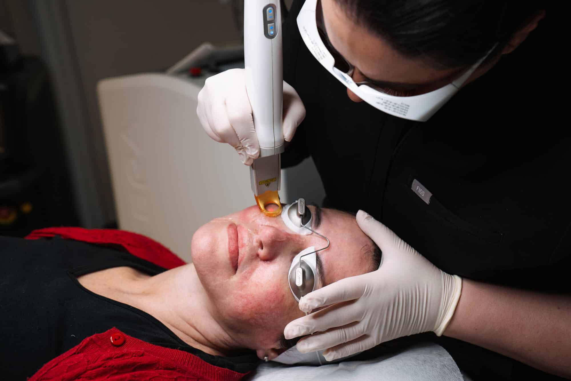 Cosmetic Treatment Options for Rosacea and Facial Redness from Contour Clinics in Sydney and Brisbane