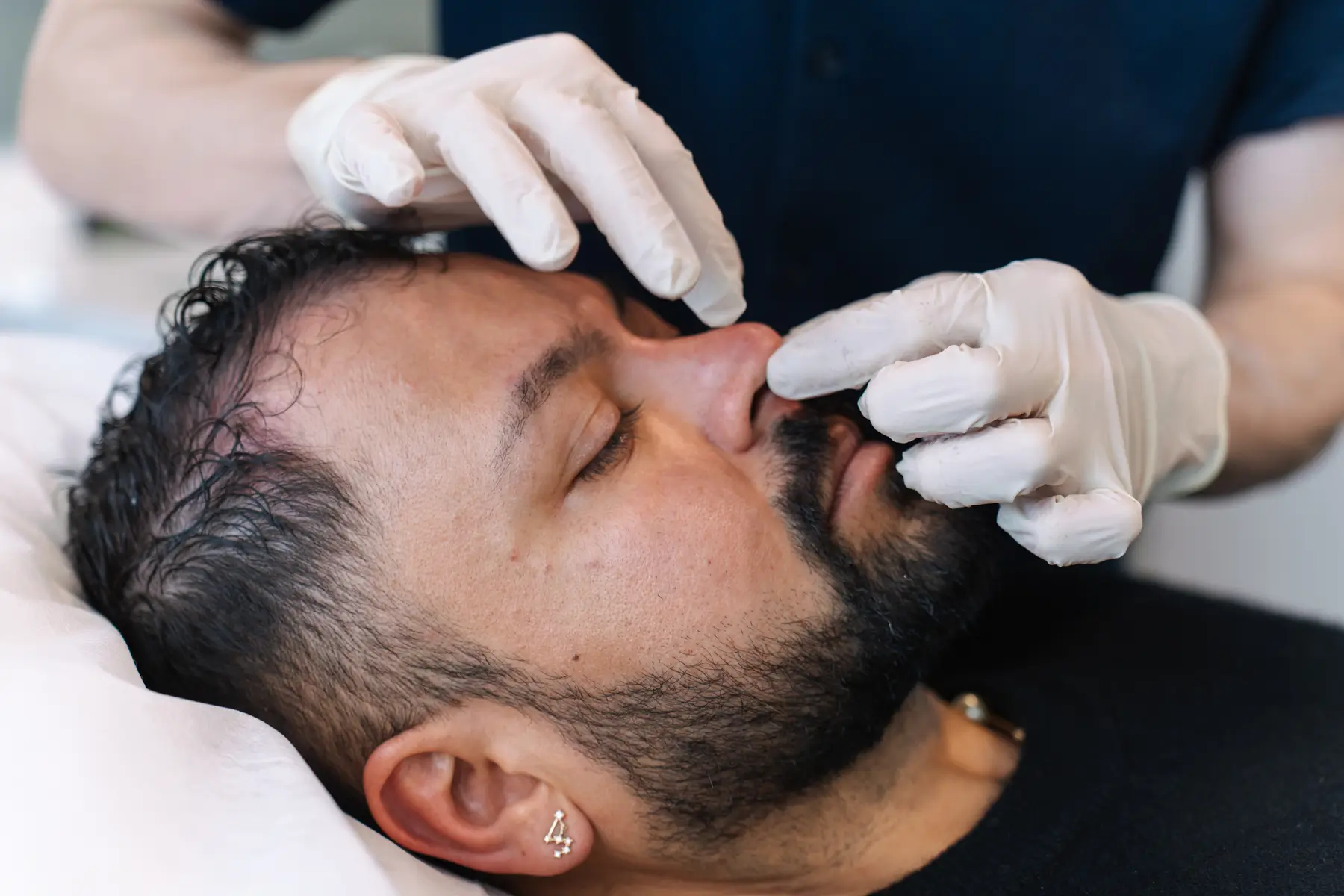 Non-Surgical Nose Consultation in Sydney and Brisbane with cosmetic doctors at Contour Clinics