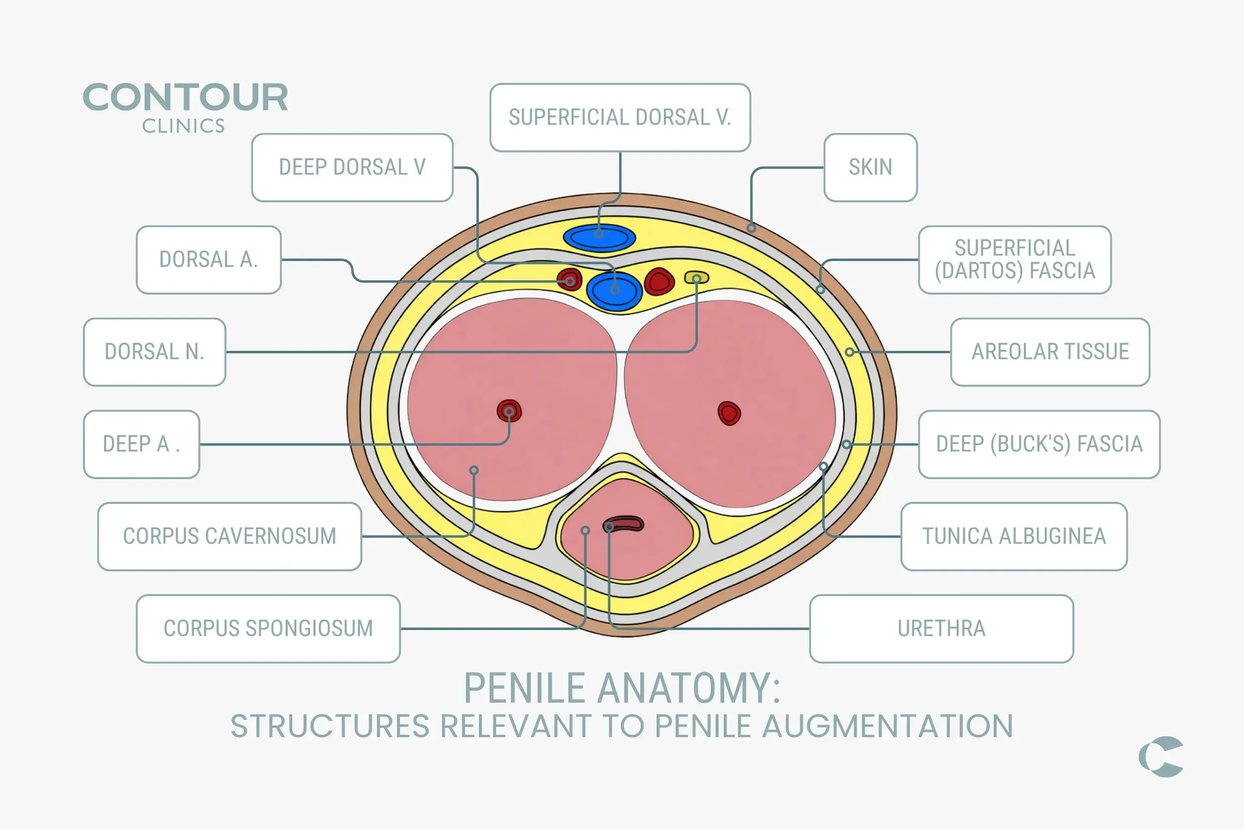 Penile augmentation diagram showing anatomy considered