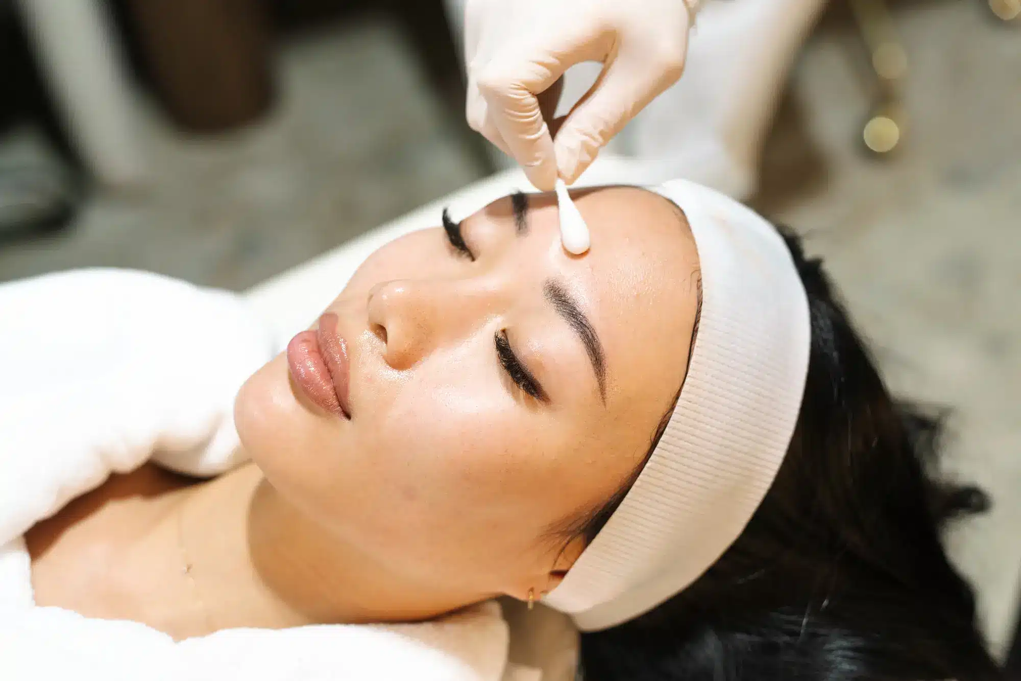 Chemical Peels in Sydney and Brisbane at Contour Clinics