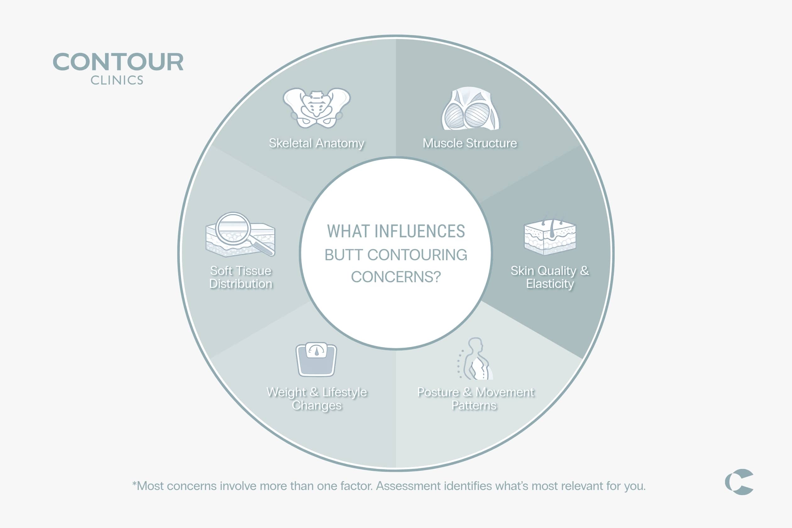 What Can Influence Buttock Shape And Hip Dips, discussed in a butt contouring consultation with cosmetic doctors in Sydney and Brisbane at Contour Clinics