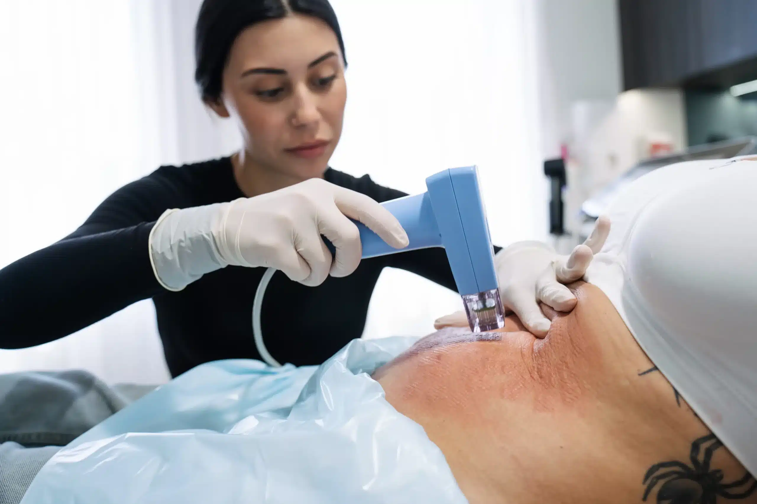 Dermal Therapist treating a patient with Morpheus8 on the stomach for Body Fat Remodelling in Sydney at Contour Clinics