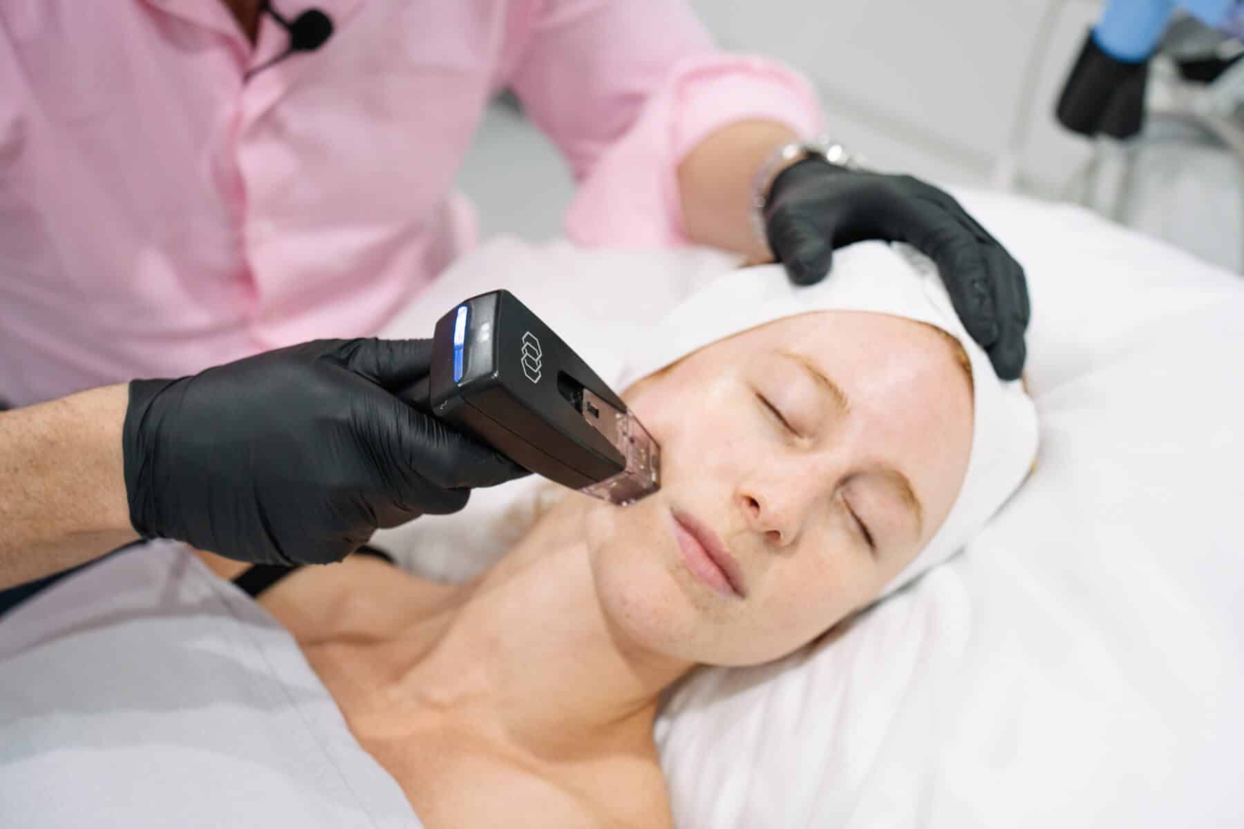 How Often Should You Do Morpheus8 RF Microneedling