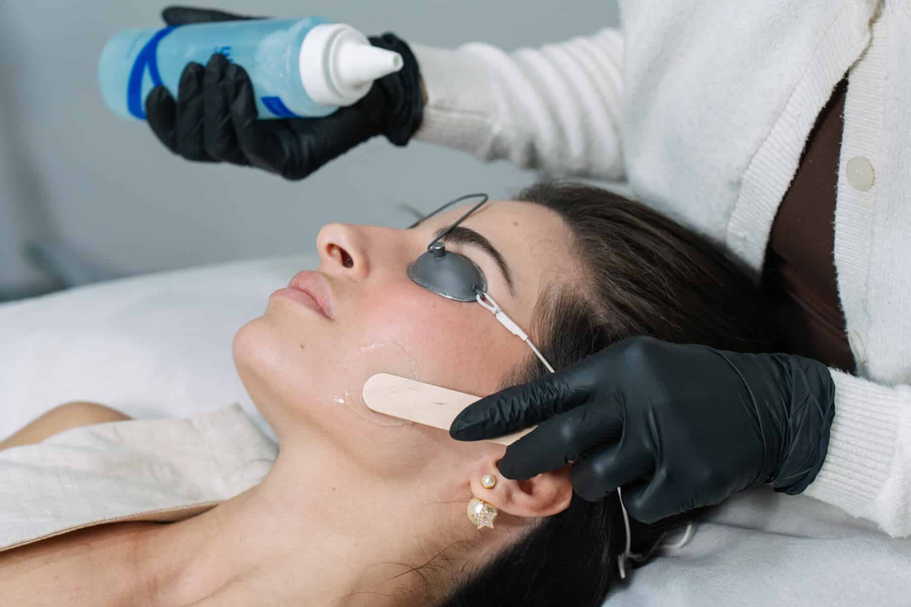 Benefits of IPL laser for your skin