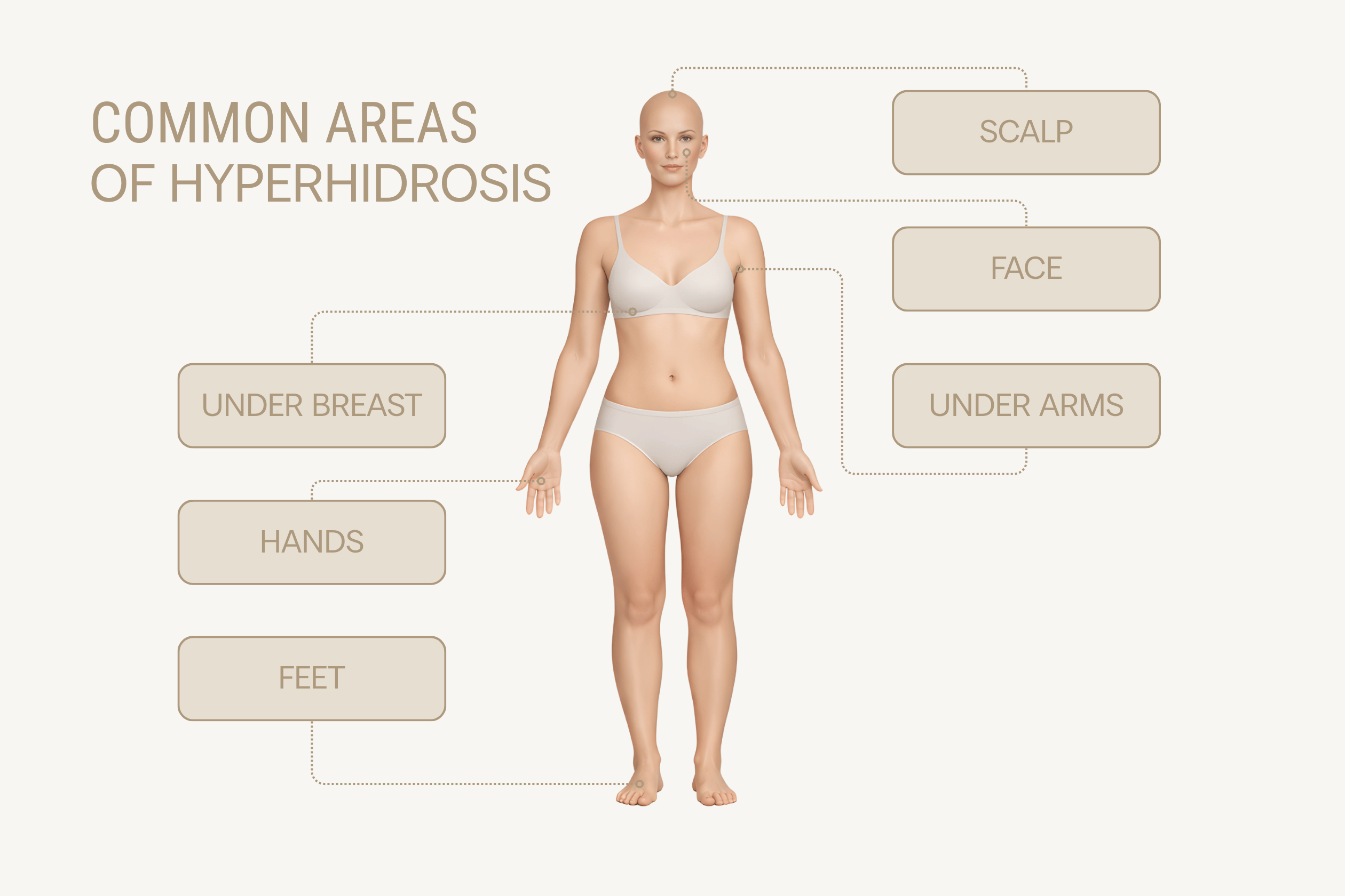 Treatment areas discussed for hyperphidrosis by expert sweat doctors at Contour Clinics