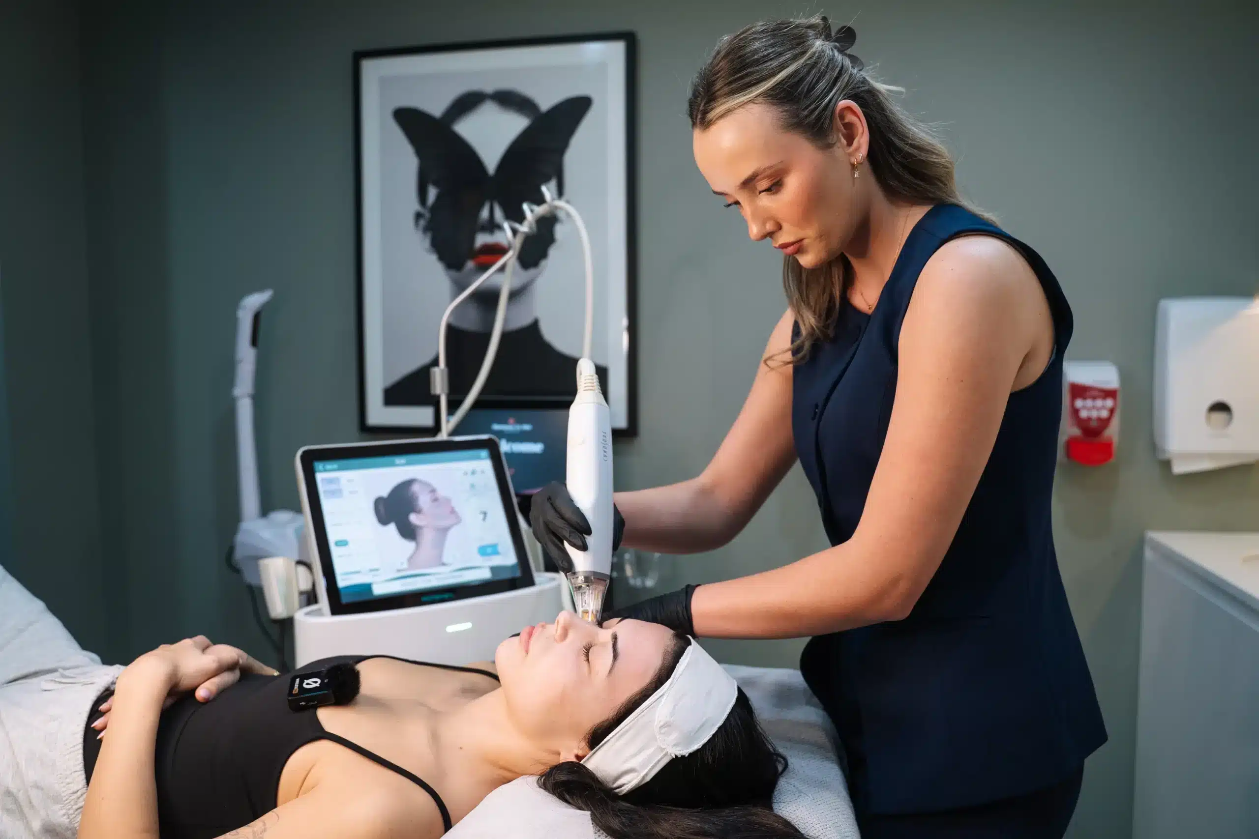 A dermal therapist treats a patient's face with Potenza RF microneedling and explains what is Potenza RF Microneedling - with cosmetic practitioners at Contour Clinics Sydney and Brisbane