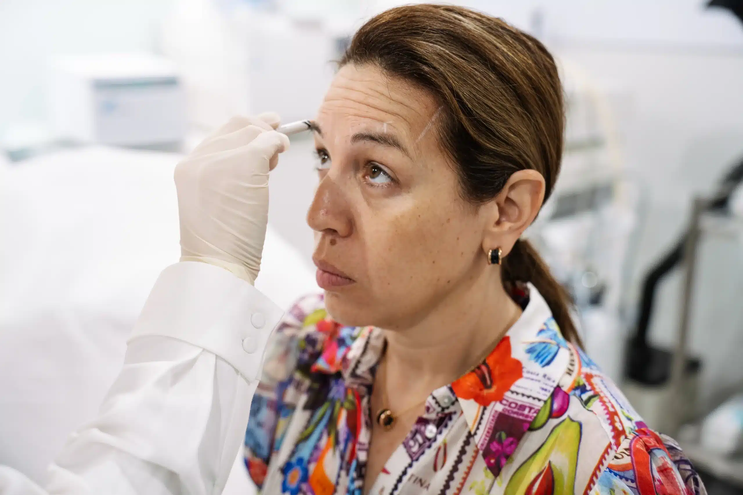 Forehead Wrinkle Consultations Sydney and Brisbane