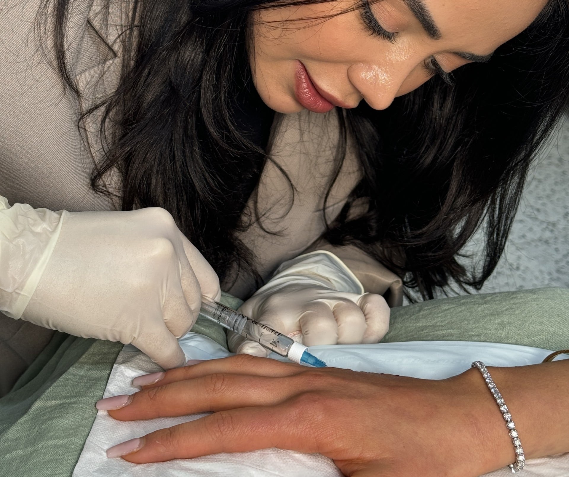 Rejuran treatment on hands Sydney and Brisbane