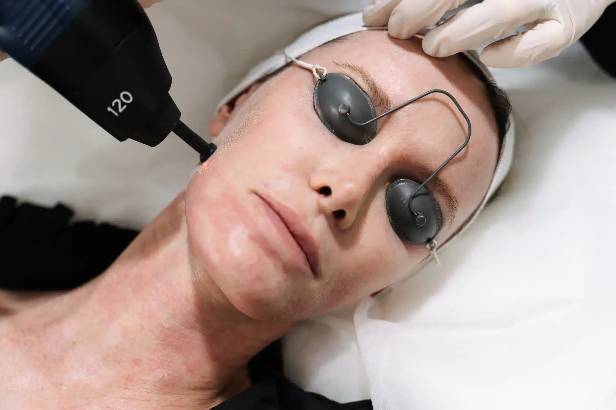 Co2 laser can help tighten sagging jowls at Contour Clinics Sydney and Brisbane
