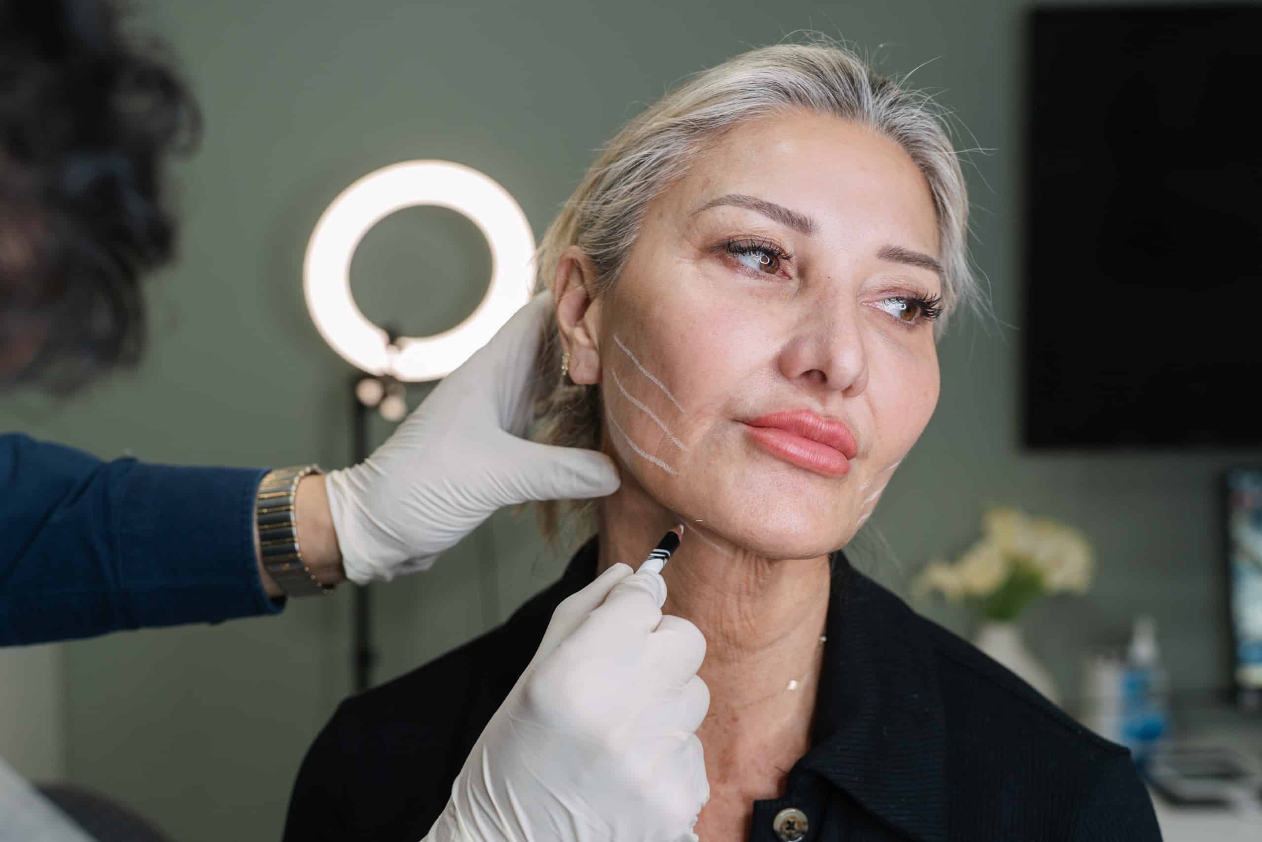 Facial hreads treatment for mature skin, provided by cosmetic doctors at Contour Clinics