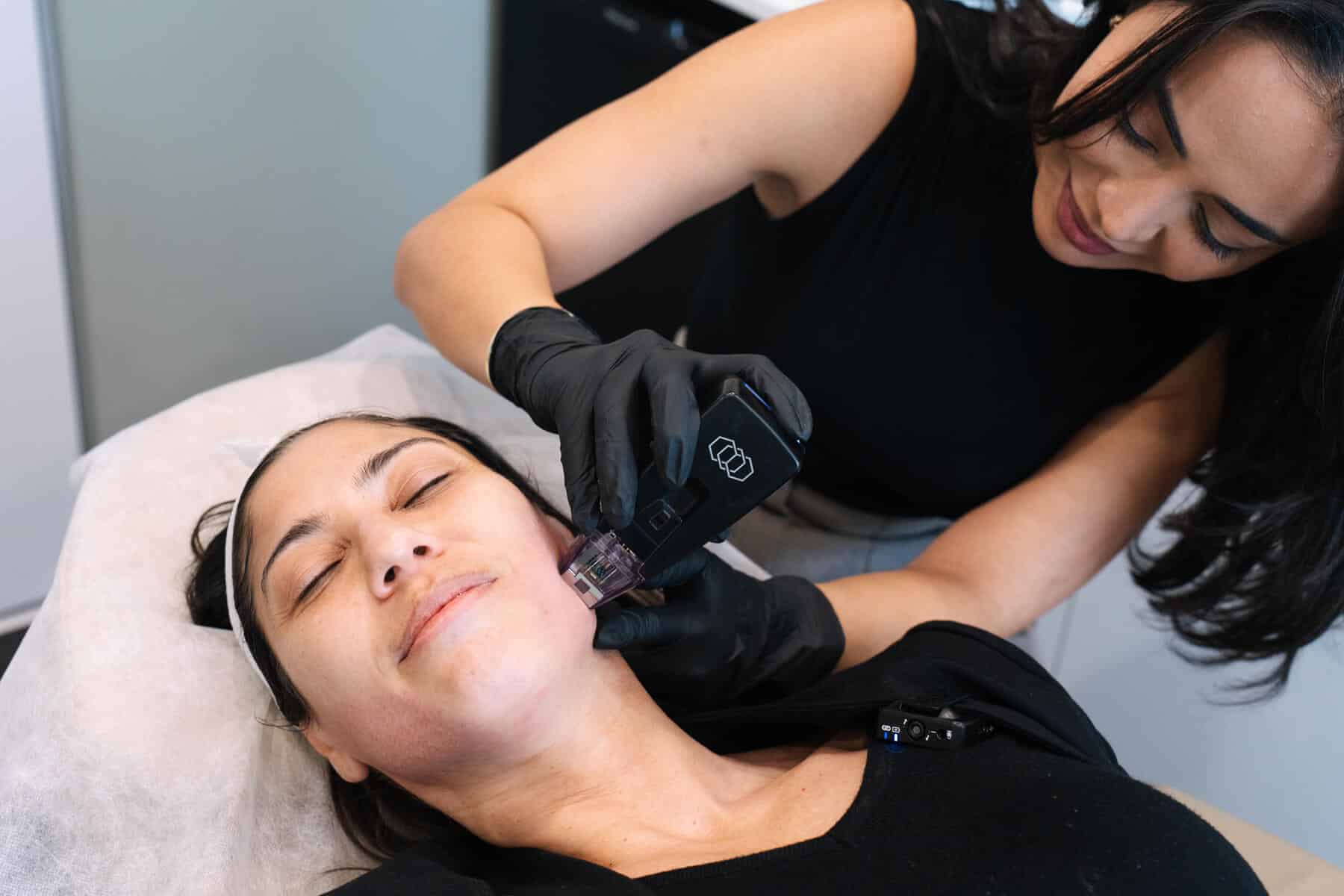 Cosmetic nurse applying exosomes with micro needling to a woman's face, while she lies on a treatment bed 