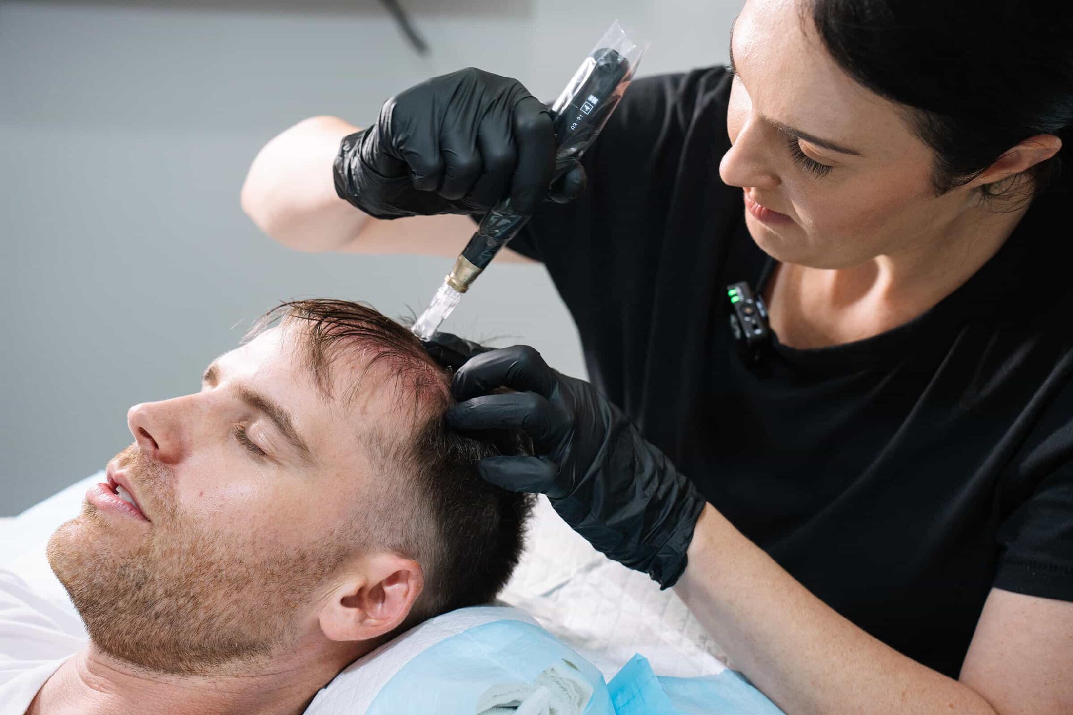Hair biostimulation with skin needling and exosomes to reverse hair loss with cosmetic doctors in Sydney and Brisbane at Contour Clinics