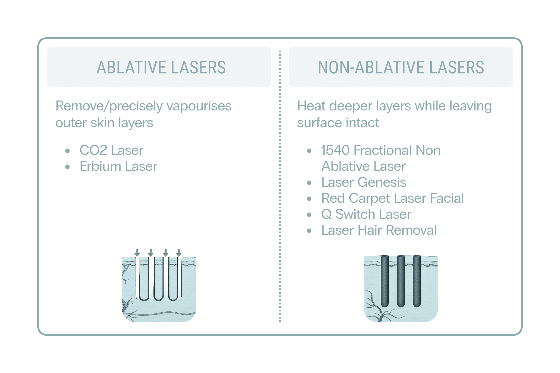 Table comparing Ablative-vs-Non ablative laser treatments by cosmetic doctors at Contour Clinics