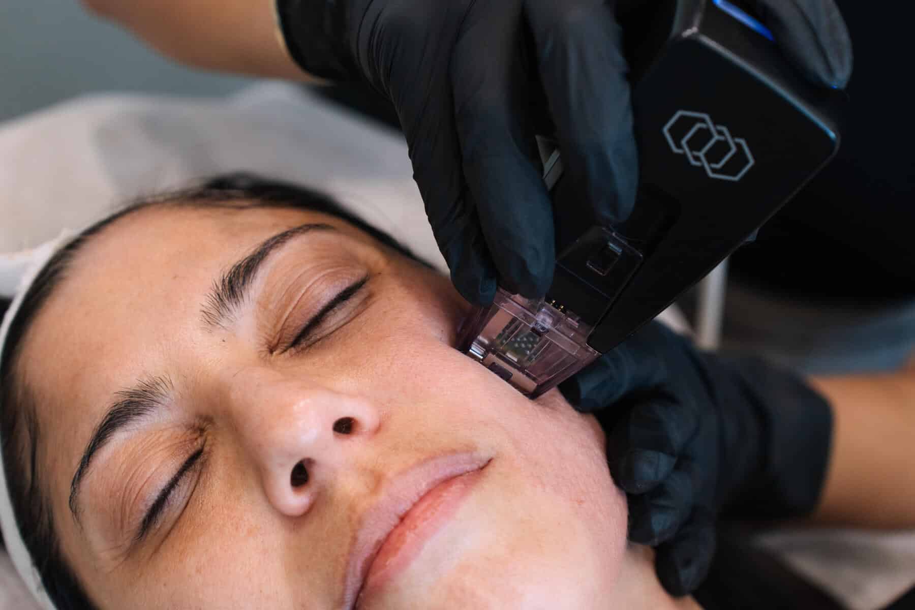 What Is The Best Laser Procedure For Me?
