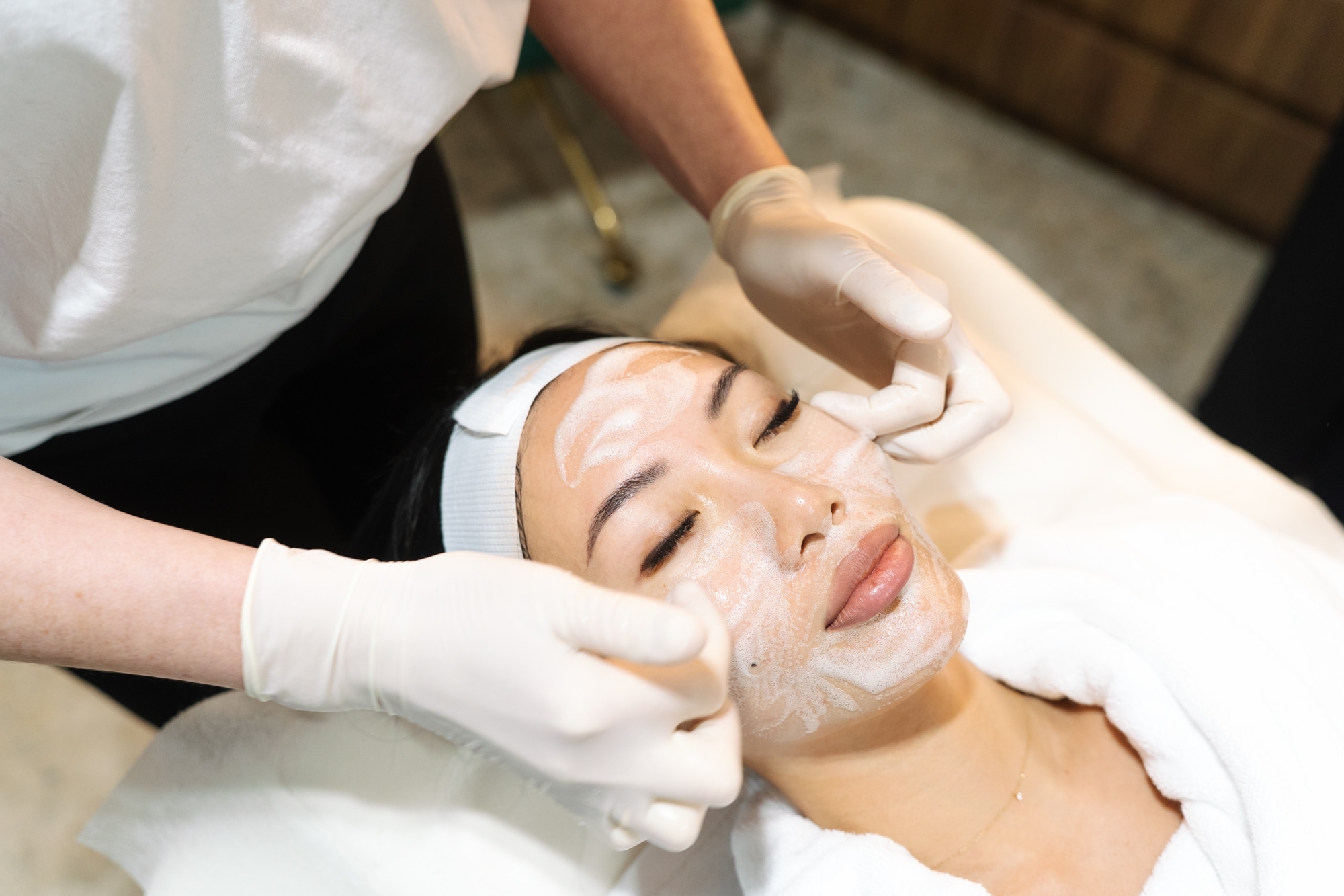 Salicylic acid peel in Brisbane and Sydney wth dermal therapists