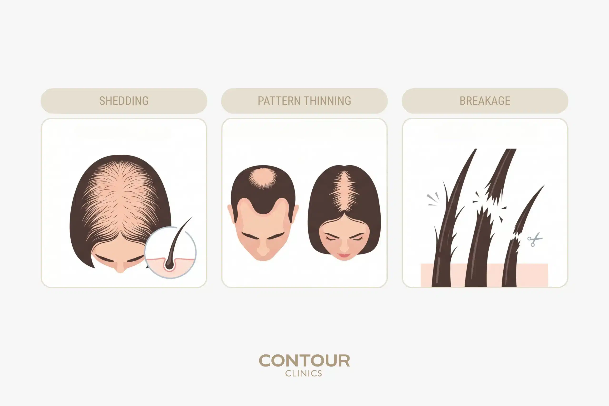 The difference between hair shedding and hair thinning