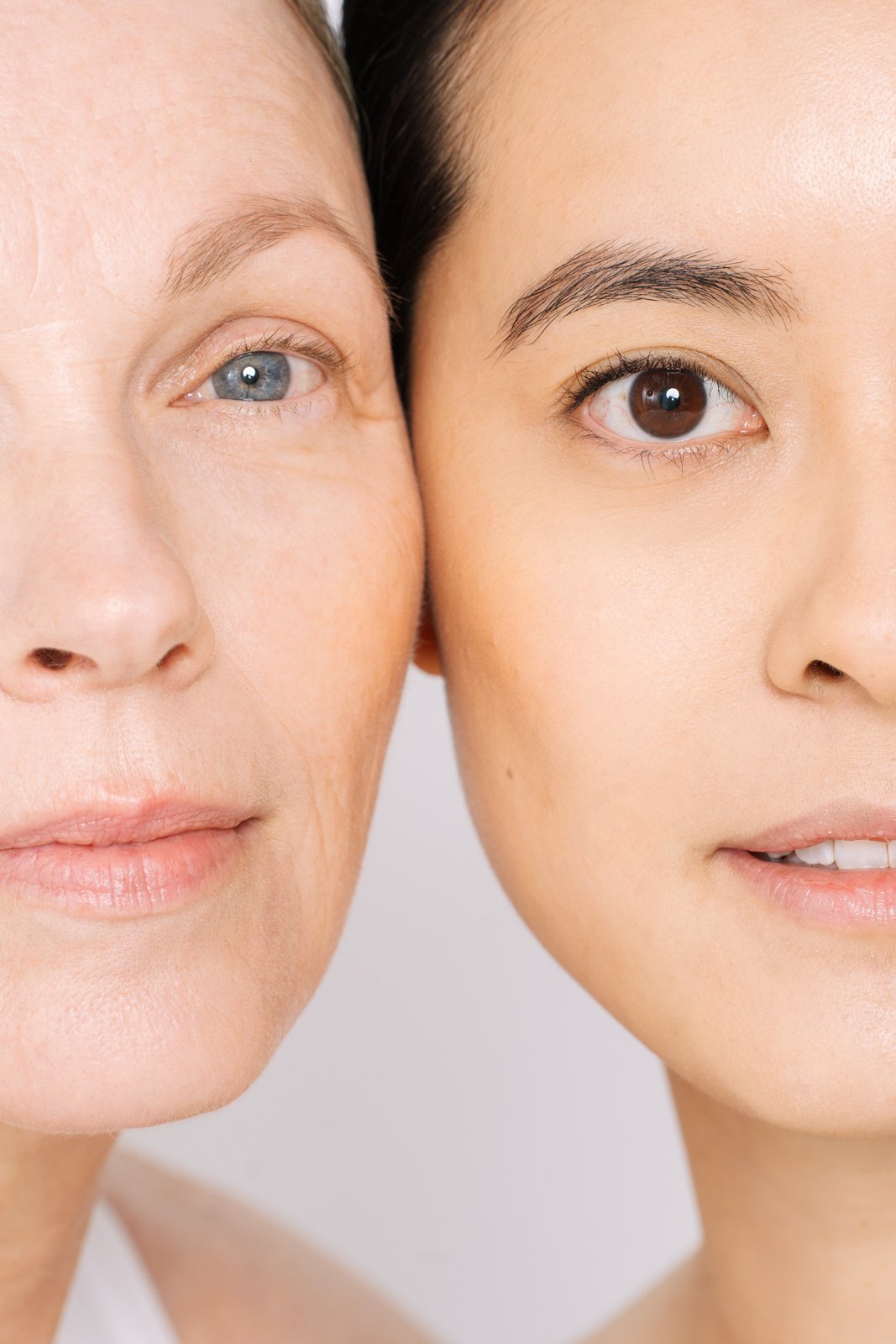 Nasolabial fold filler sydney