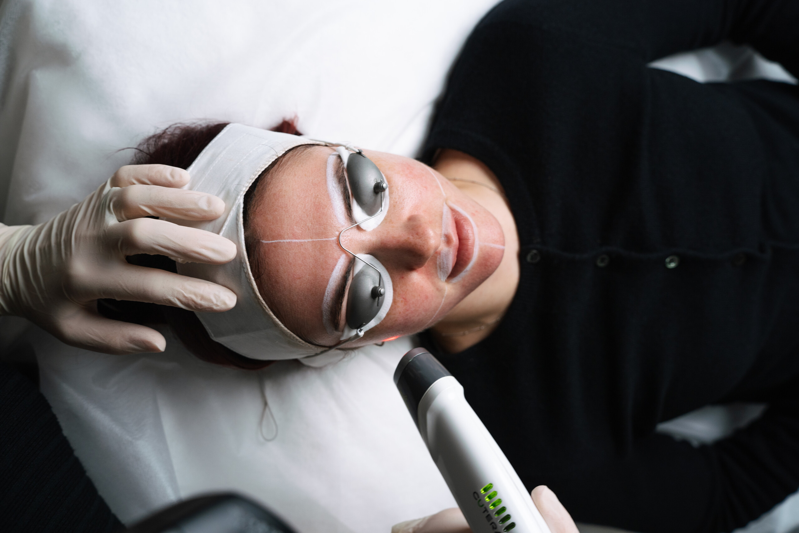 Laser Genesis at Contour Clinics
