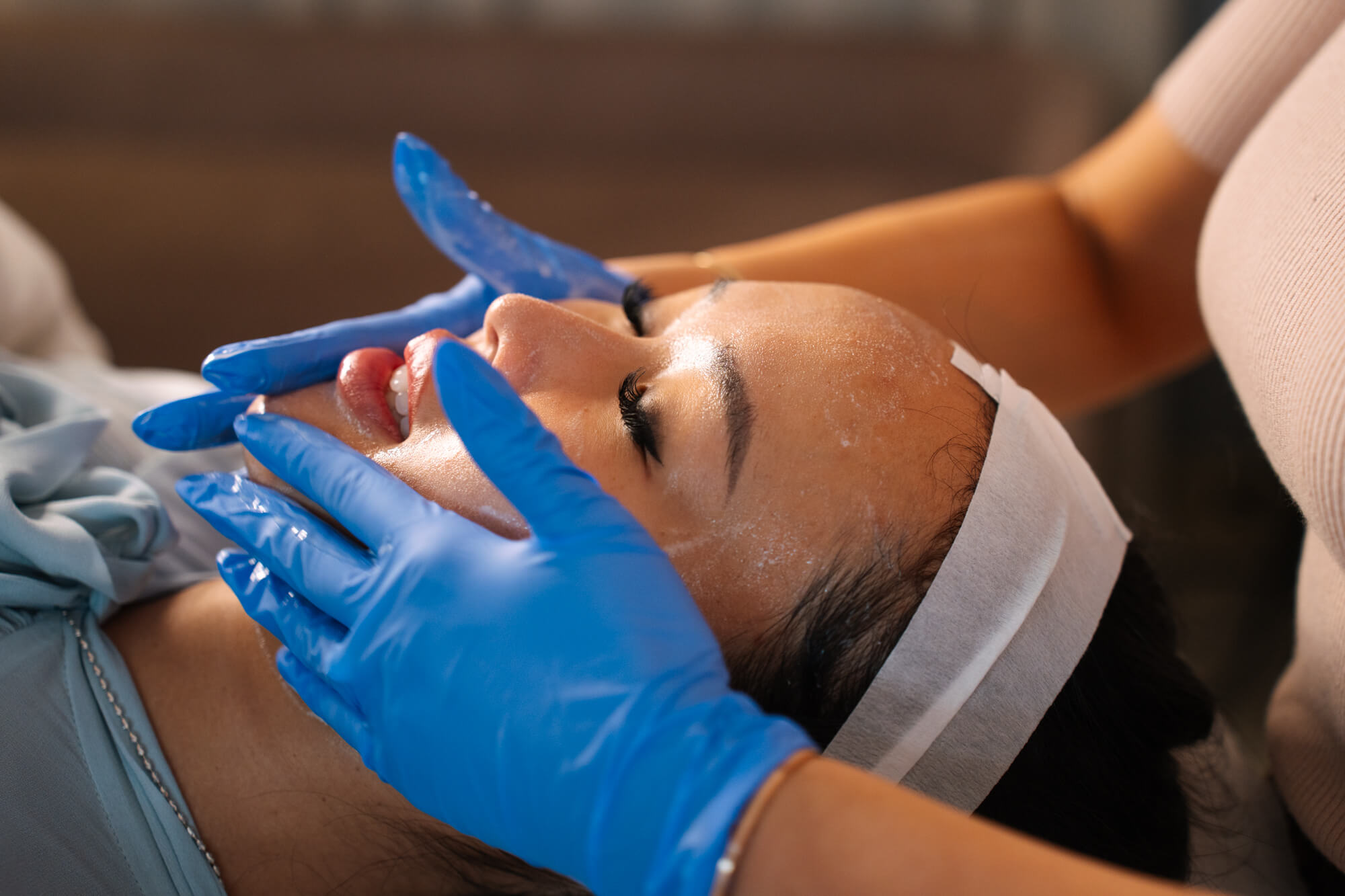 How do chemical peels work for pigmentation?