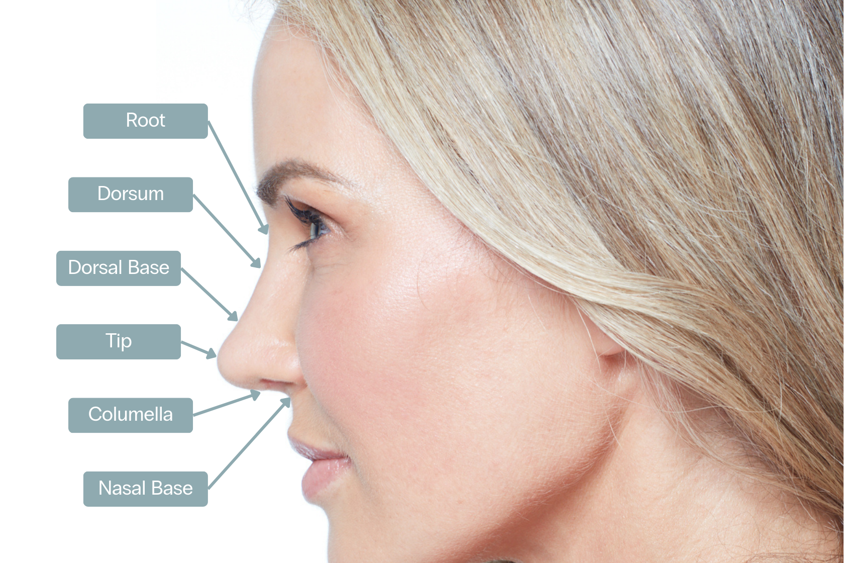 Nose filler sydney