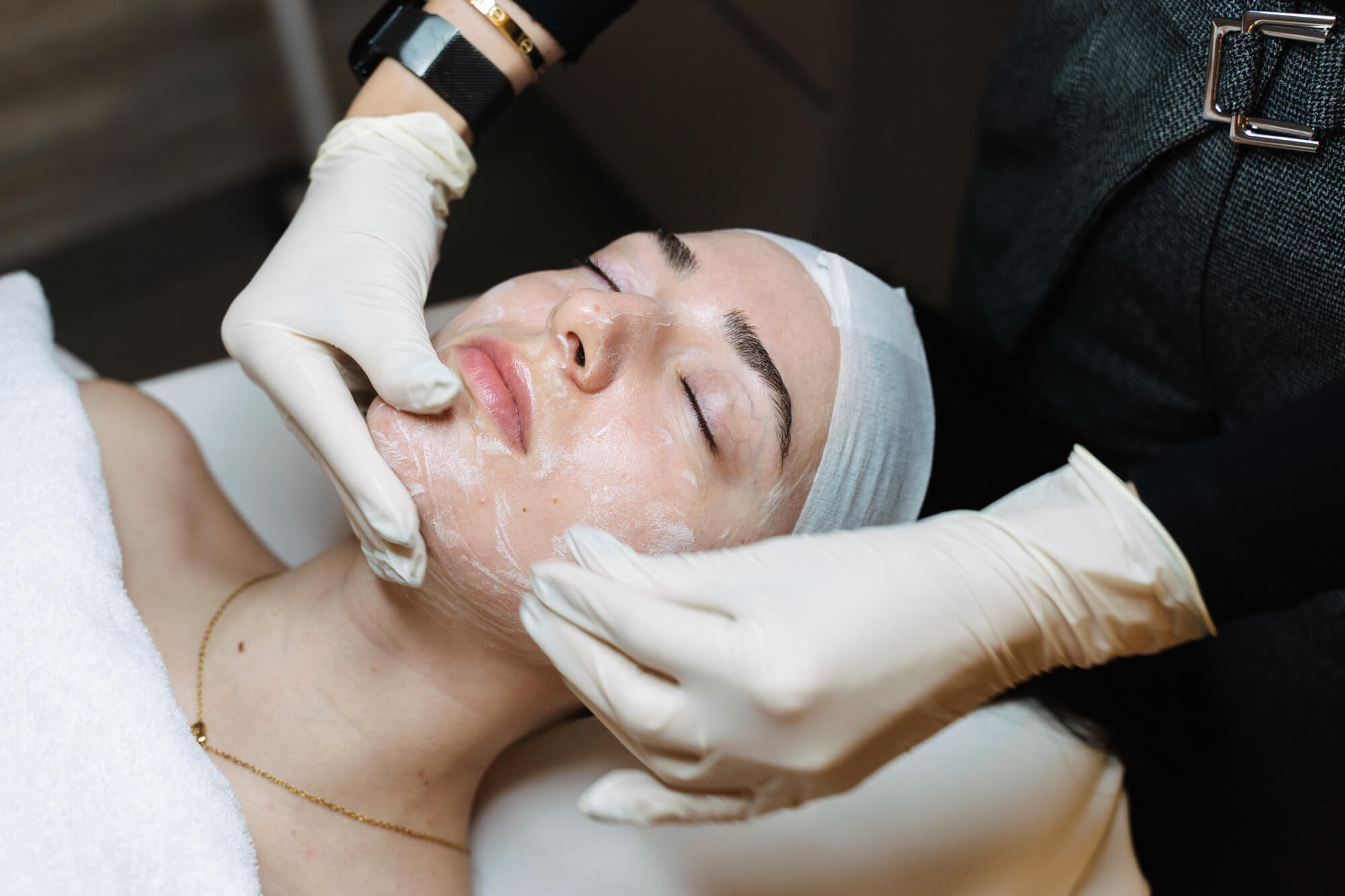 Dermamelan Peel in Sydney by dermal therapists at Contour Clinics