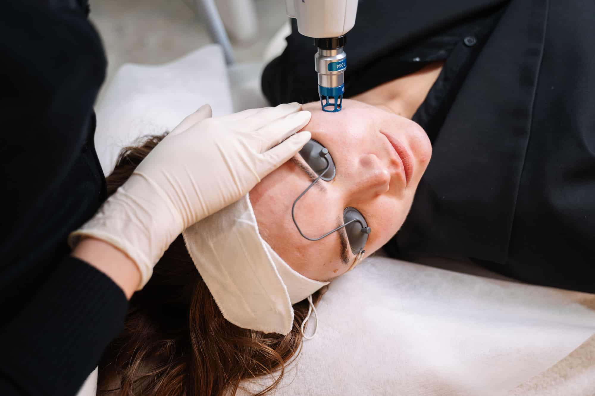 Q switch laser for scar removal in Sydney and Brisbane at Contour Clinics