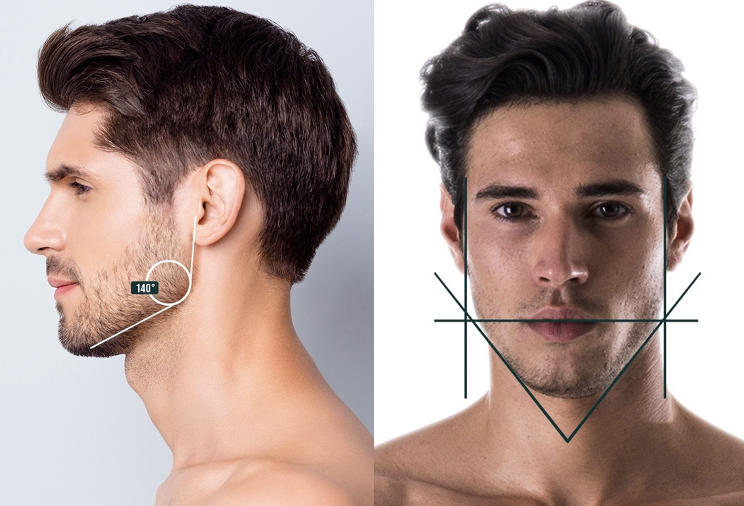 The Rise of Jawline Fillers for Men - The Cosmetic Skin Clinic