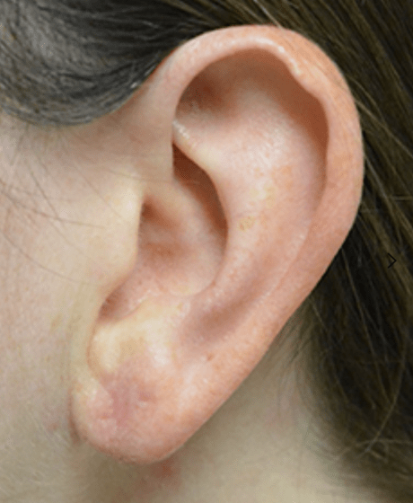 Earring Lifters for Stretched Earlobes  Earrings, Earring hacks, Big  earrings