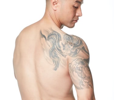 Laser tattoo removal sydney least painful