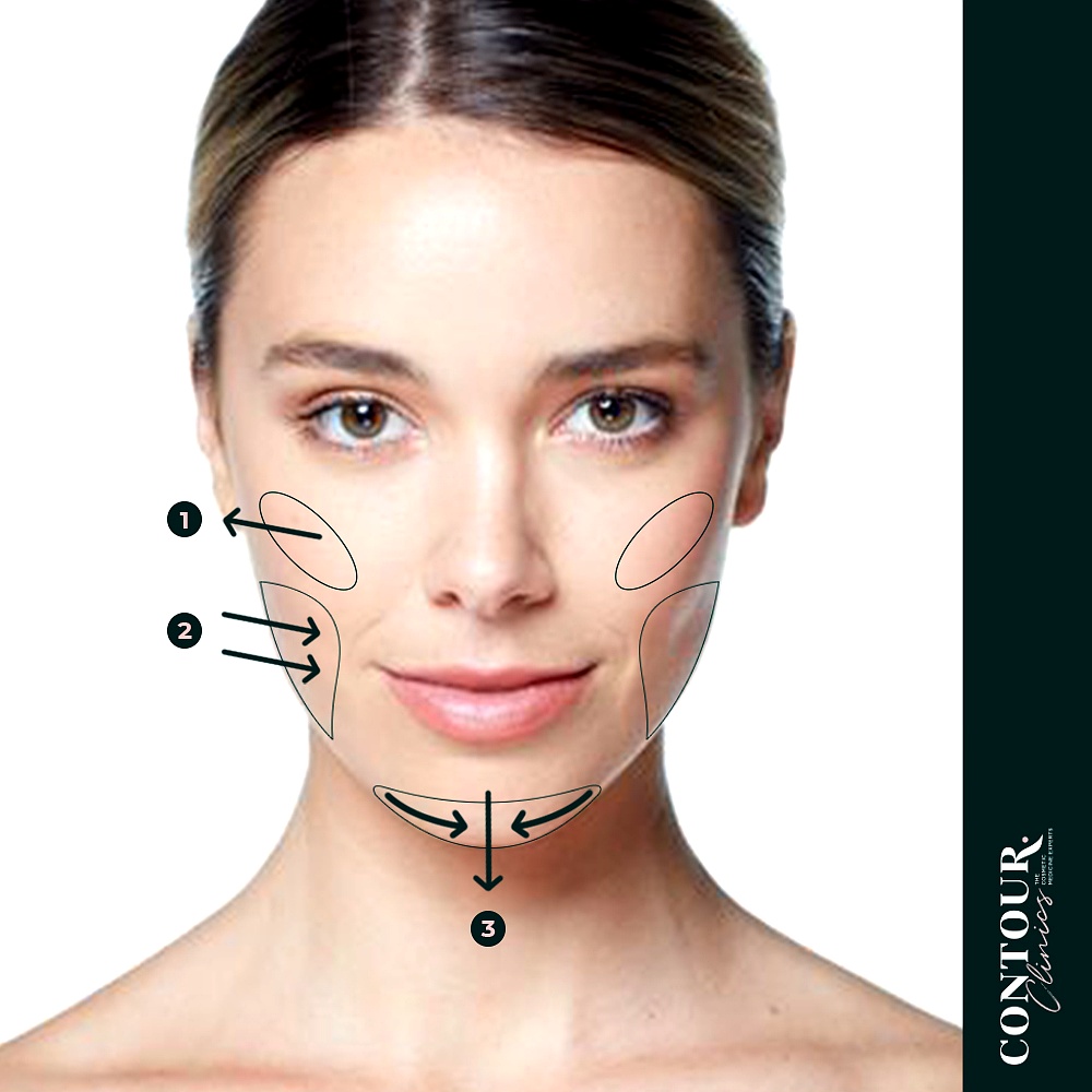 Facial slimming botox