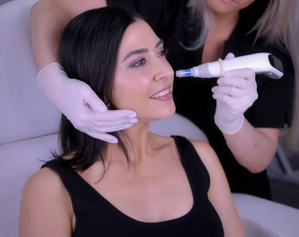 Photo of woman having skin needling treatment