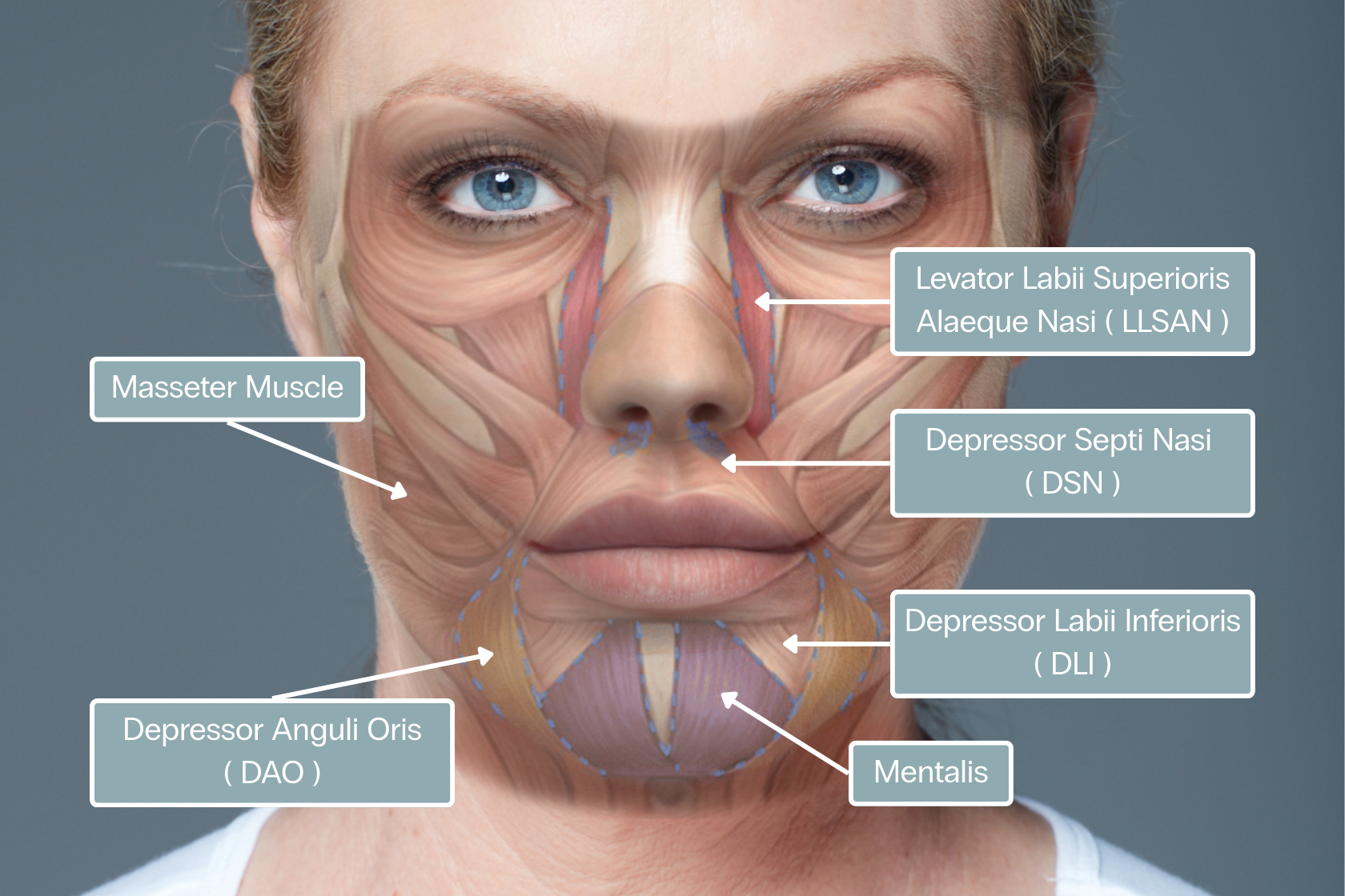 DAO botox